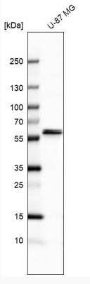 Western Blot: CARS2 Antibody [NBP2-32597]