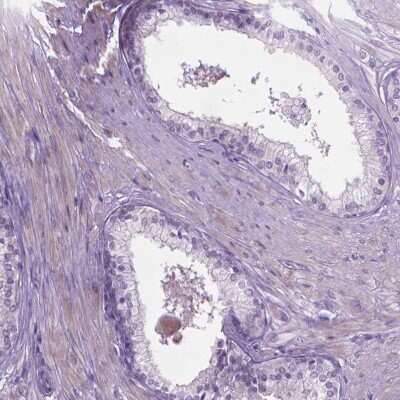 Immunohistochemistry-Paraffin: CASC1 Antibody [NBP1-83810]