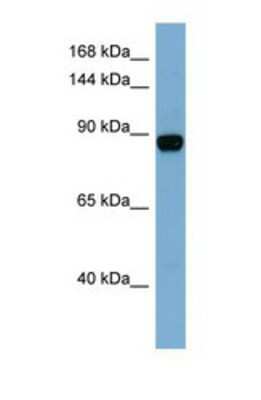 Western Blot: CASD1 Antibody [NBP1-69609]