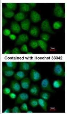 Immunocytochemistry/ Immunofluorescence: CASK Antibody [NBP2-15710]