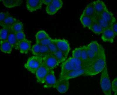 Immunocytochemistry/ Immunofluorescence: CASK Antibody [NBP2-76922]