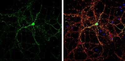 Immunocytochemistry/ Immunofluorescence: CASK Antibody [NBP3-13185]