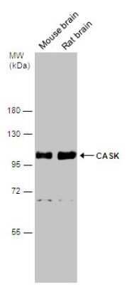 Western Blot: CASK Antibody [NBP3-13185]