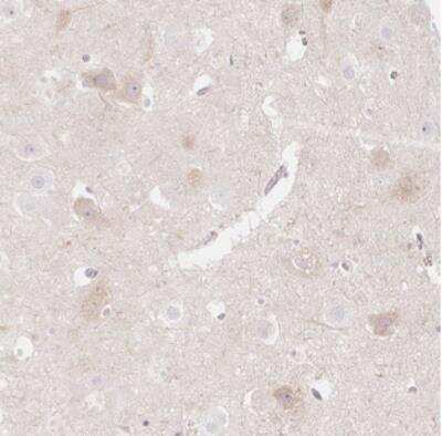 Immunohistochemistry: CASK Interacting Protein 1 Antibody [NBP2-30414]