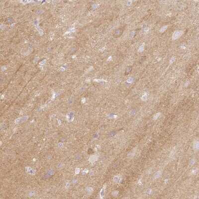 Immunohistochemistry-Paraffin: CASK Interacting Protein 1 Antibody [NBP2-30414]