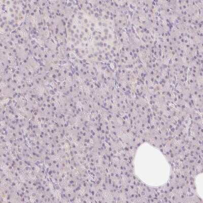 Immunohistochemistry-Paraffin: CASK Interacting Protein 1 Antibody [NBP2-30414]