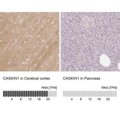 Immunohistochemistry-Paraffin: CASK Interacting Protein 1 Antibody [NBP2-30414]