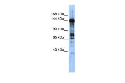Western Blot: CASZ1 Antibody [NBP2-87125]