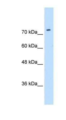 Western Blot: CAT1 Antibody [NBP1-59857]