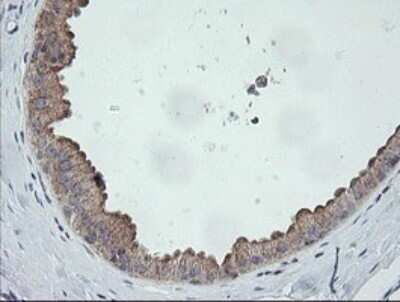 Immunohistochemistry: CATIP Antibody (OTI4B4) - Azide and BSA Free [NBP2-72506]