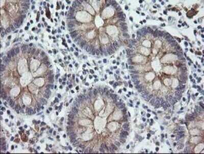 Immunohistochemistry: CATIP Antibody (OTI4B4) - Azide and BSA Free [NBP2-72506]