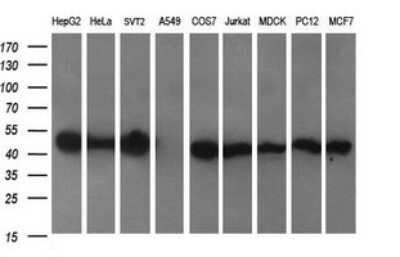 Western Blot: CATIP Antibody (OTI4B4)Azide and BSA Free [NBP2-72506]