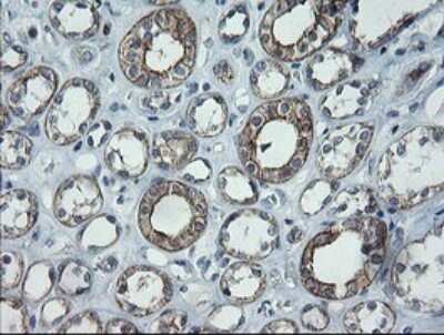 Immunohistochemistry: CATIP Antibody (OTI4B4) [NBP2-45568]