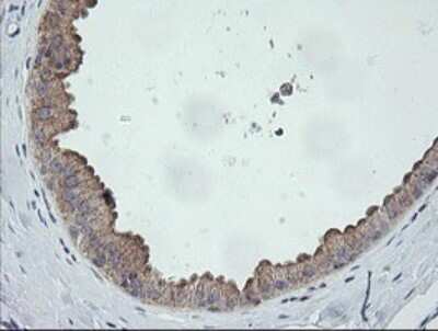 Immunohistochemistry: CATIP Antibody (OTI4B4) [NBP2-45568]
