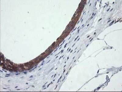 Immunohistochemistry: CATIP Antibody (OTI4B4) [NBP2-45568]