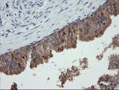 Immunohistochemistry: CATIP Antibody (OTI4B4) [NBP2-45568]