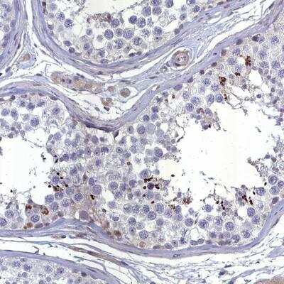 Immunohistochemistry-Paraffin: CATSPER4 Antibody [NBP1-91751]
