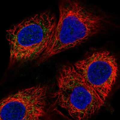 Immunocytochemistry/ Immunofluorescence: CBARA1 Antibody [NBP2-58173]