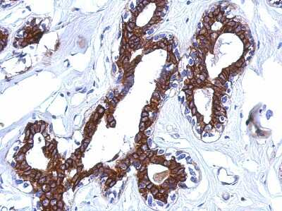 Immunohistochemistry-Paraffin: CBCP6 Antibody [NBP2-15729]