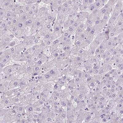 Immunohistochemistry-Paraffin: CBE1 Antibody [NBP2-14425]