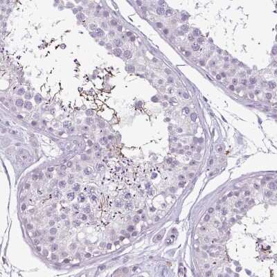 Immunohistochemistry-Paraffin: CBE1 Antibody [NBP2-14425]