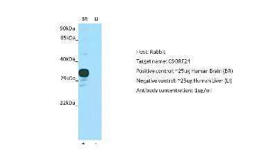Western Blot: CBE1 Antibody [NBP2-82994]