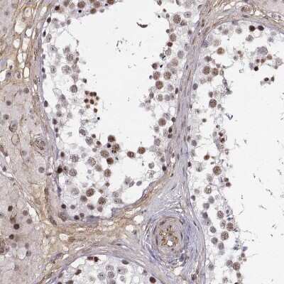 Immunohistochemistry-Paraffin: CBF1-interacting corepressor Antibody [NBP2-68775]