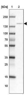 Western Blot: CBF2 Antibody [NBP2-47525]