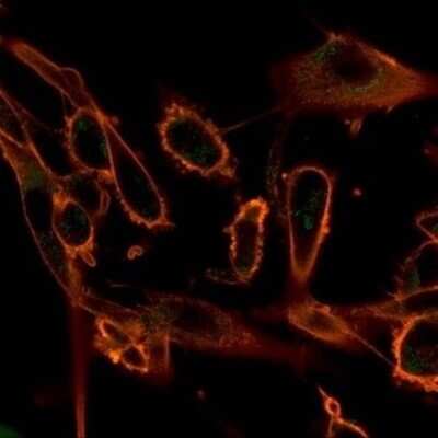 Immunocytochemistry/ Immunofluorescence: CBFB Antibody (PCRP-CBFB-1E6) [NBP3-13808]
