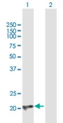 Western Blot: CBFB Antibody [H00000865-B01P]