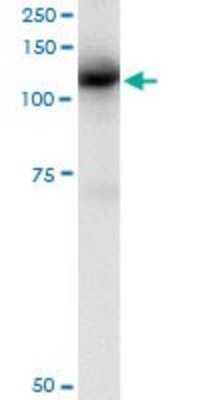 Immunoprecipitation: CBL Antibody (6D12) [H00000867-M01]