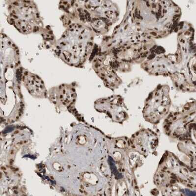 Immunohistochemistry-Paraffin: CBLL1 Antibody [NBP1-83589]