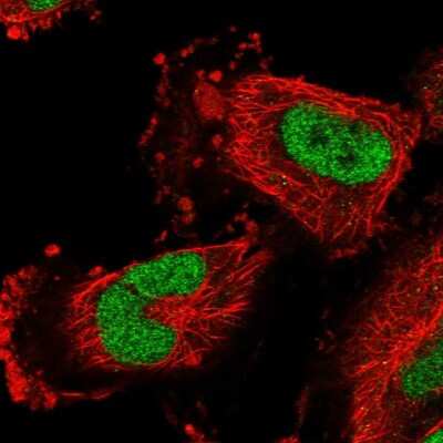 Immunocytochemistry/ Immunofluorescence: CBLN3 Antibody [NBP1-85844]