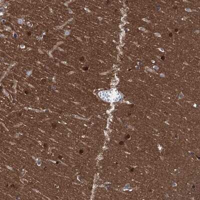 Immunohistochemistry-Paraffin: CBLN3 Antibody [NBP1-85844]