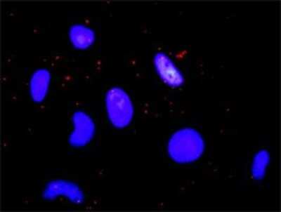 Proximity Ligation Assay: CBP/KAT3A Antibody (2H5) [H00001387-M01]