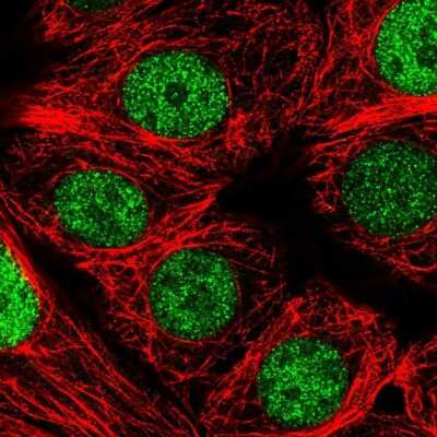 Immunocytochemistry/ Immunofluorescence: CBP20 Antibody [NBP2-56303]