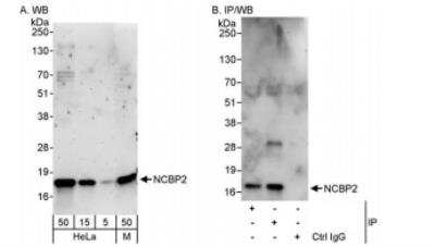 Western Blot: CBP20 Antibody [NBP1-30445]