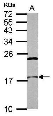 Western Blot: CBP20 Antibody [NBP2-15732]