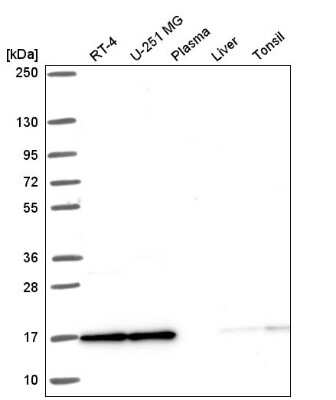 Western Blot: CBP20 Antibody [NBP2-56303]