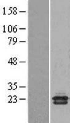 Western Blot: CBP20 Overexpression Lysate [NBL1-13507]