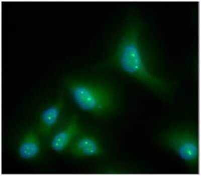 Immunocytochemistry/ Immunofluorescence: CBR1 Antibody (2D6) - BSA Free [NBP2-59397]
