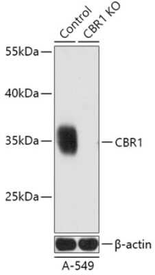 Western Blot: CBR1 AntibodyAzide and BSA Free [NBP3-03418]