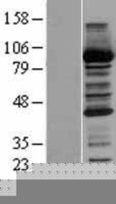 Western Blot: CBR1 Overexpression Lysate [NBP2-04206]
