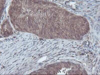 Immunohistochemistry-Paraffin: CBR3 Antibody (OTI1G6) [NBP2-00997]