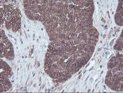 Immunohistochemistry-Paraffin: CBR3 Antibody (OTI1G6) [NBP2-00997]