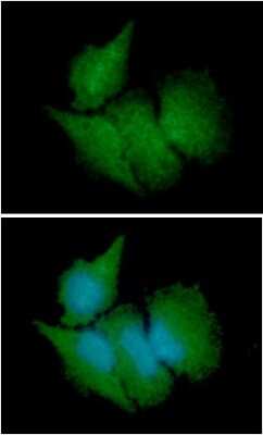 Immunocytochemistry/ Immunofluorescence: CBR3 Antibody (7E8) - BSA Free [NBP2-59401]