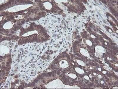 Immunohistochemistry: CBR3 Antibody (OTI1G6) - Azide and BSA Free [NBP2-70343]