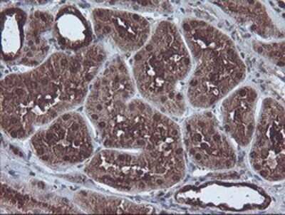 Immunohistochemistry: CBR3 Antibody (OTI1G6) - Azide and BSA Free [NBP2-70343]