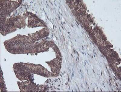 Immunohistochemistry: CBR3 Antibody (OTI1G6) - Azide and BSA Free [NBP2-70343]