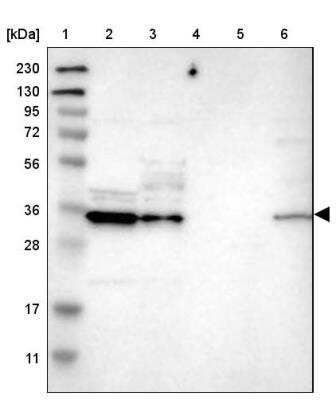 Western Blot: CBR3 Antibody [NBP1-87065]